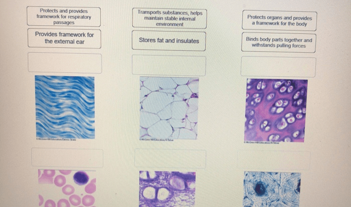 Match each connective tissue function with the appropriate image